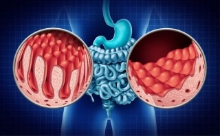 Celiachia e anemia