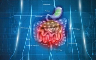 Disbiosi intestinale