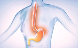 Sindrome di Mallory-Weiss