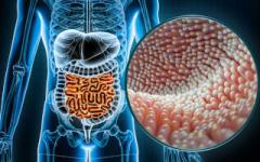 Celiachia e colon irritabile